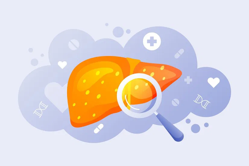 Penyebab-Penyakit-Kuning